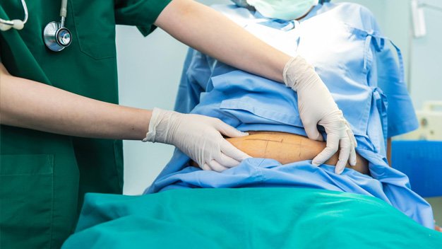 Gallstones? A Patient’s Guide to Gallbladder Removal Sur...