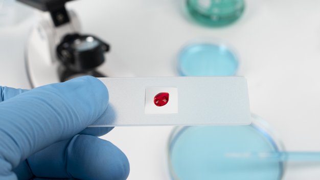 Blood in Stool: When to Panic and When It’s Probably Okay